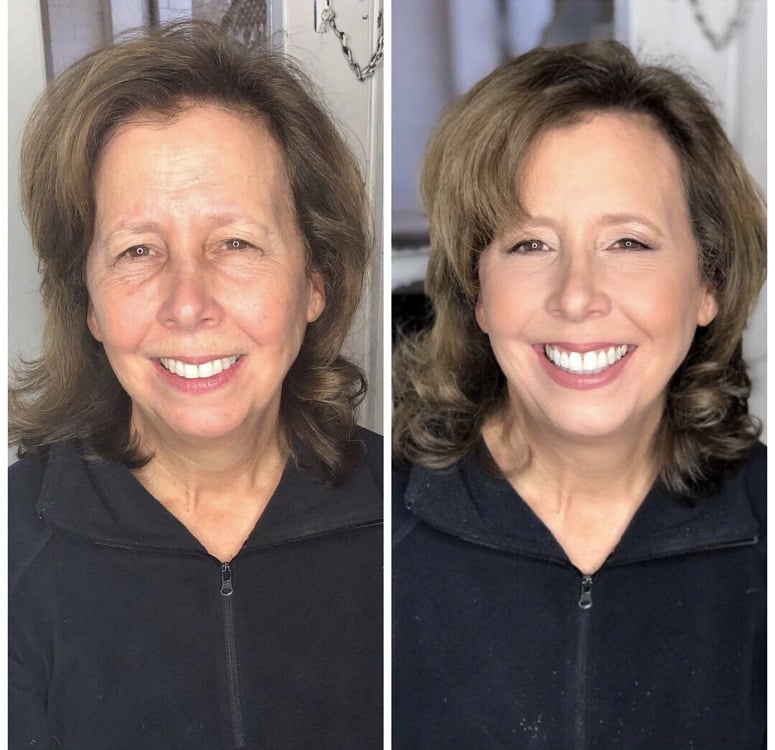 mob makeup dark undereye circles